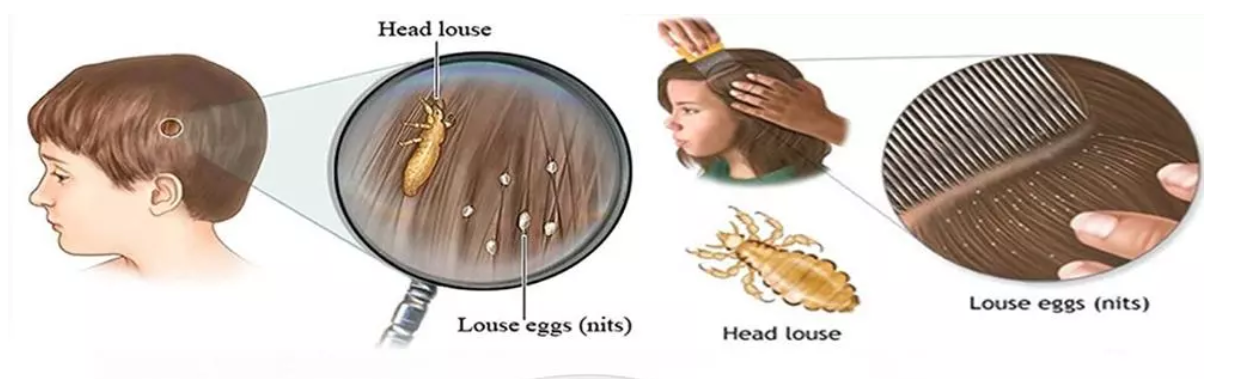 QQ截图20200317152706